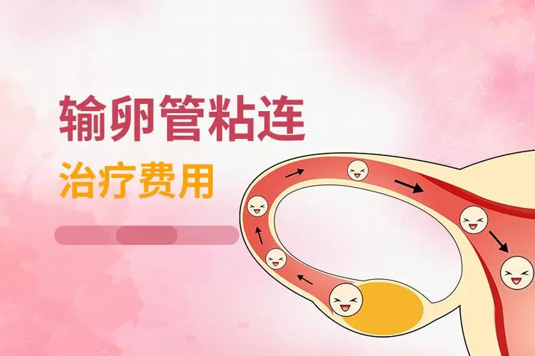 深圳輸卵管粘連怎么治療