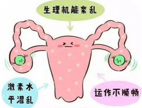驚呆！長期熬夜導(dǎo)致月經(jīng)消失，確診卵巢早衰